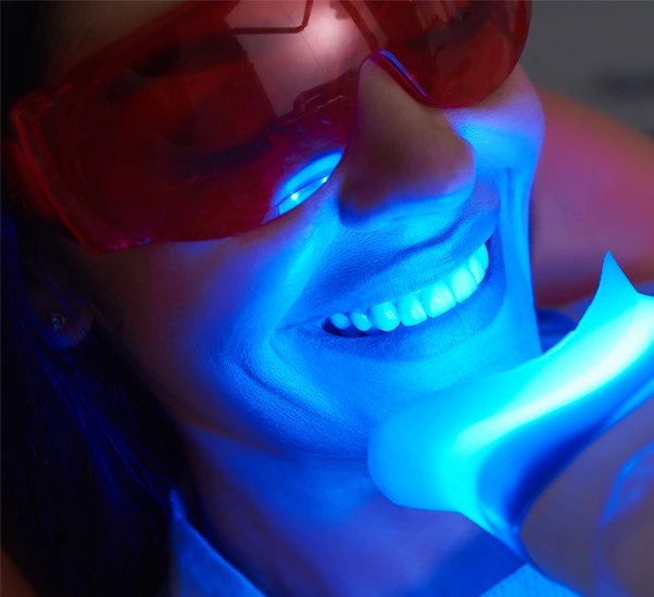 LED teeth whitening treatment